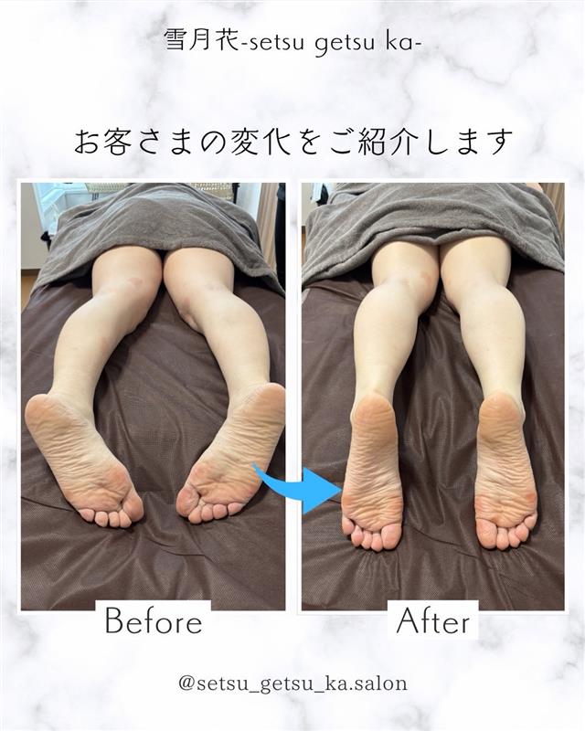 施術例2