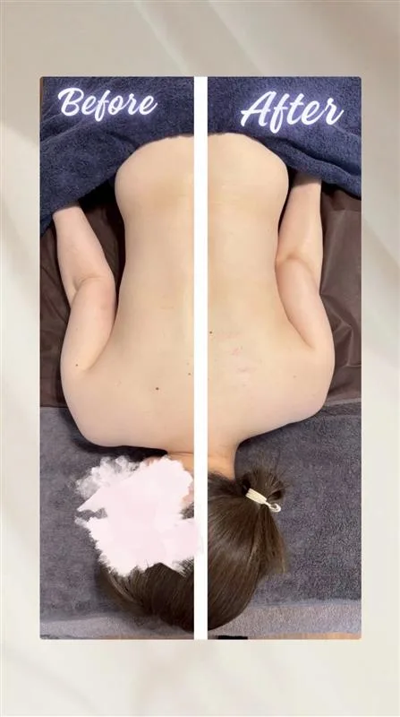 施術例3