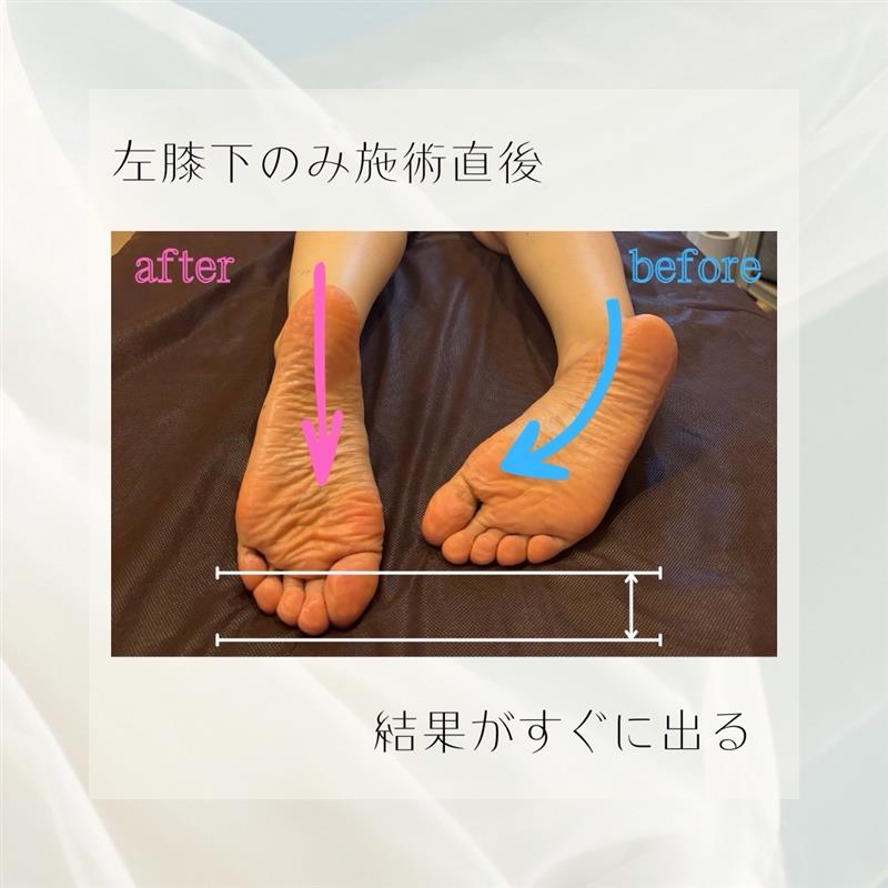 施術例5