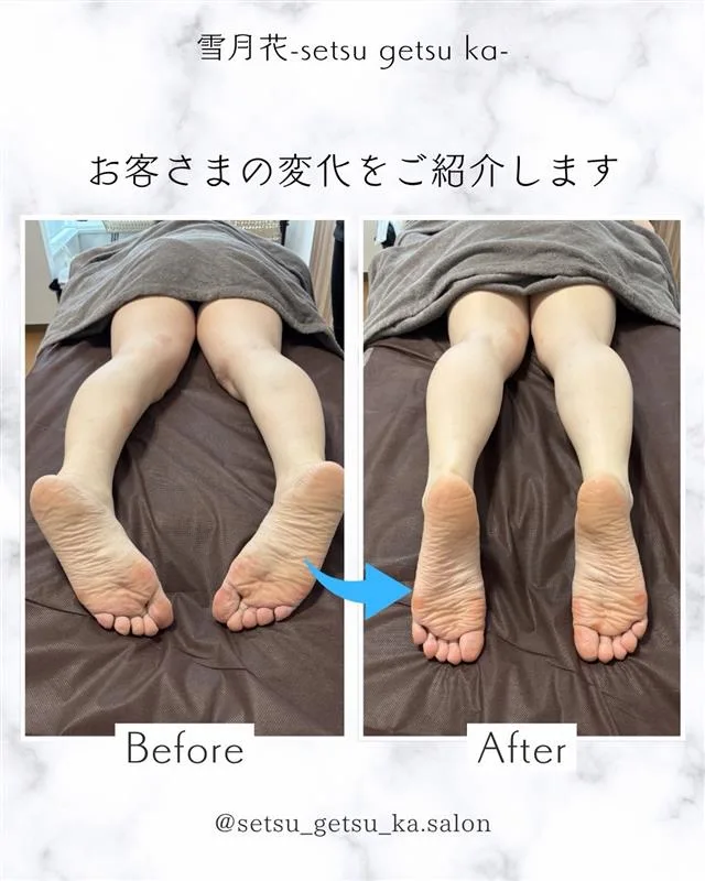 施術例6